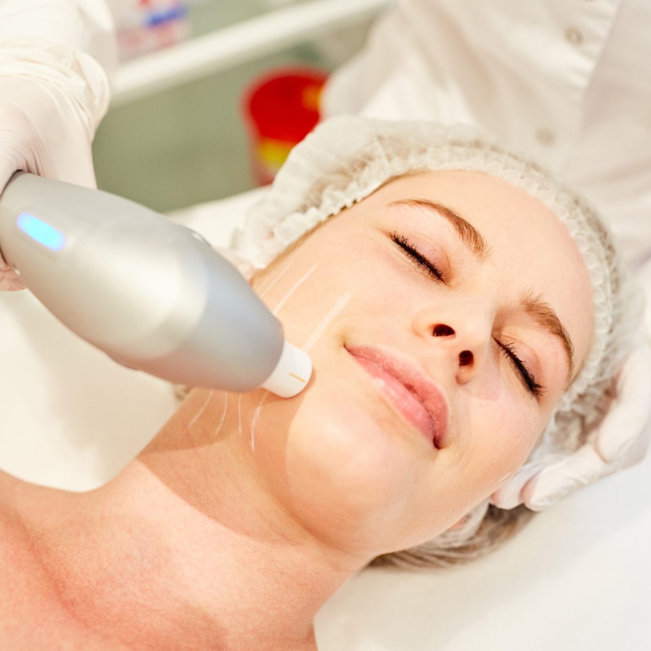 Young woman having skin tightening on face by ultrasound at dermatologist in beauty clinic